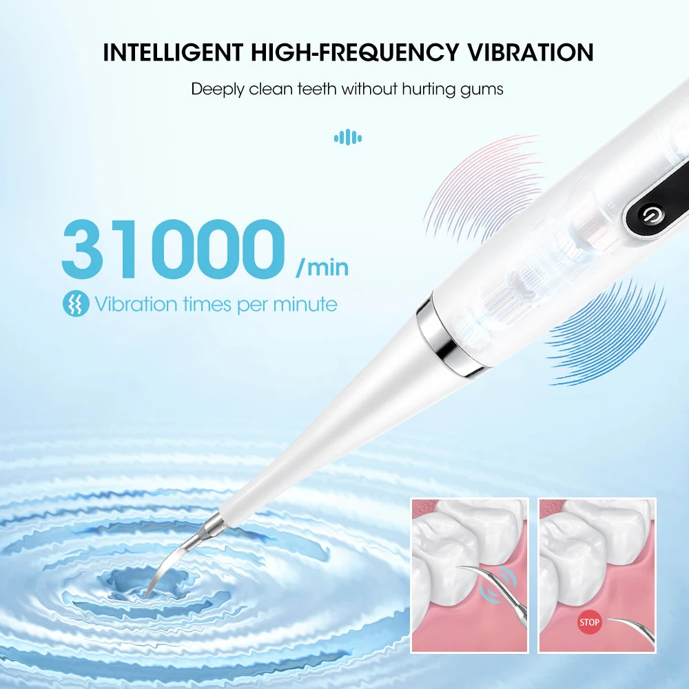 Electric Teeth Whitening Scaler – Remove Plaque & Tartar Easily